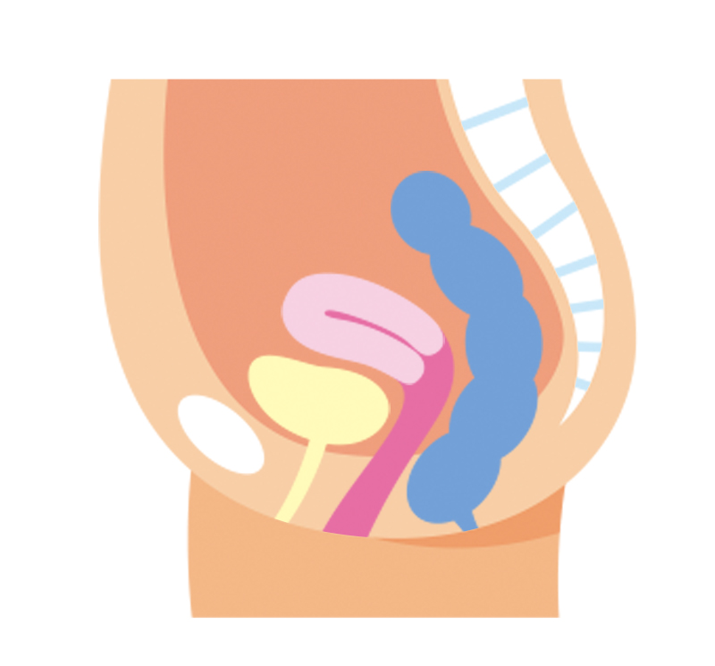 子宮脱（下垂）、膀胱瘤、直腸瘤